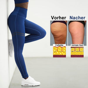 Damen Anti-Cellulite Kompression Leggings